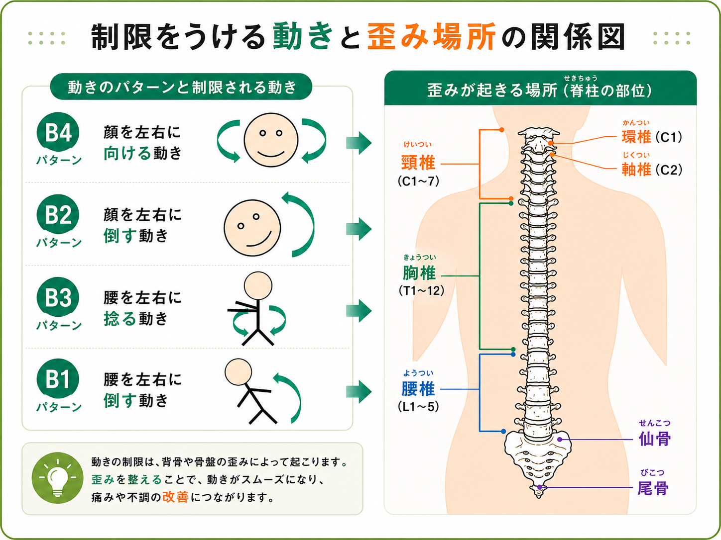 骨格のズレと痛みの関係を図解したインフォグラフィック