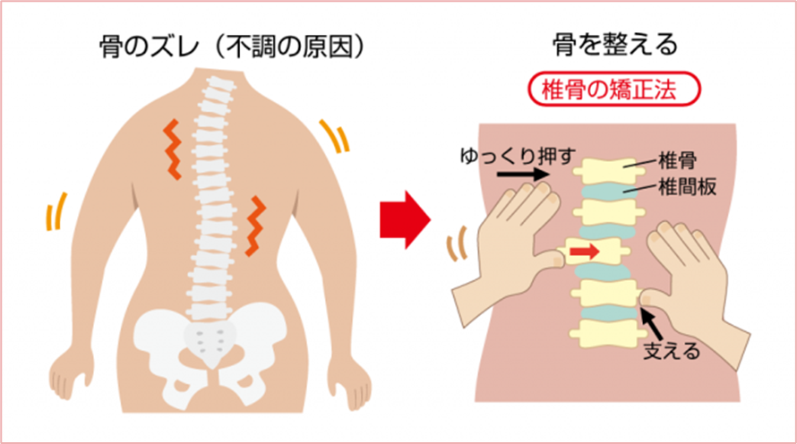 モルフォセラピー 背骨の矯正法イラスト
