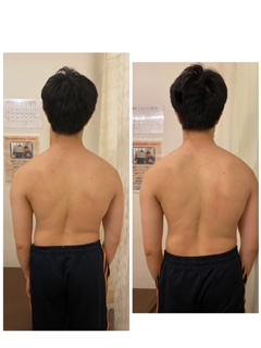 歪みと痛みは比例しない の症例写真