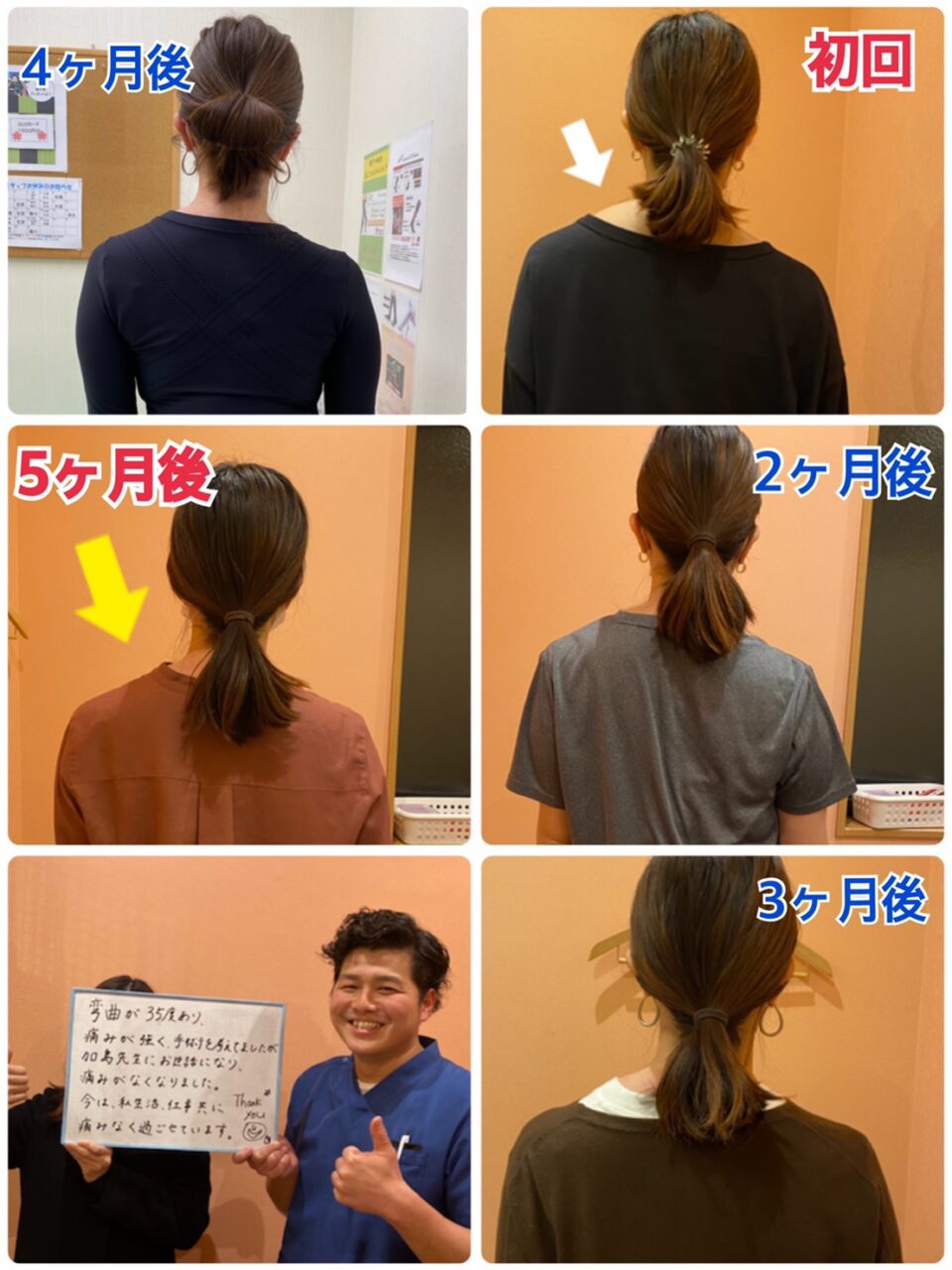医者にはオペ、オペ、オペと言われ続けた の症例写真