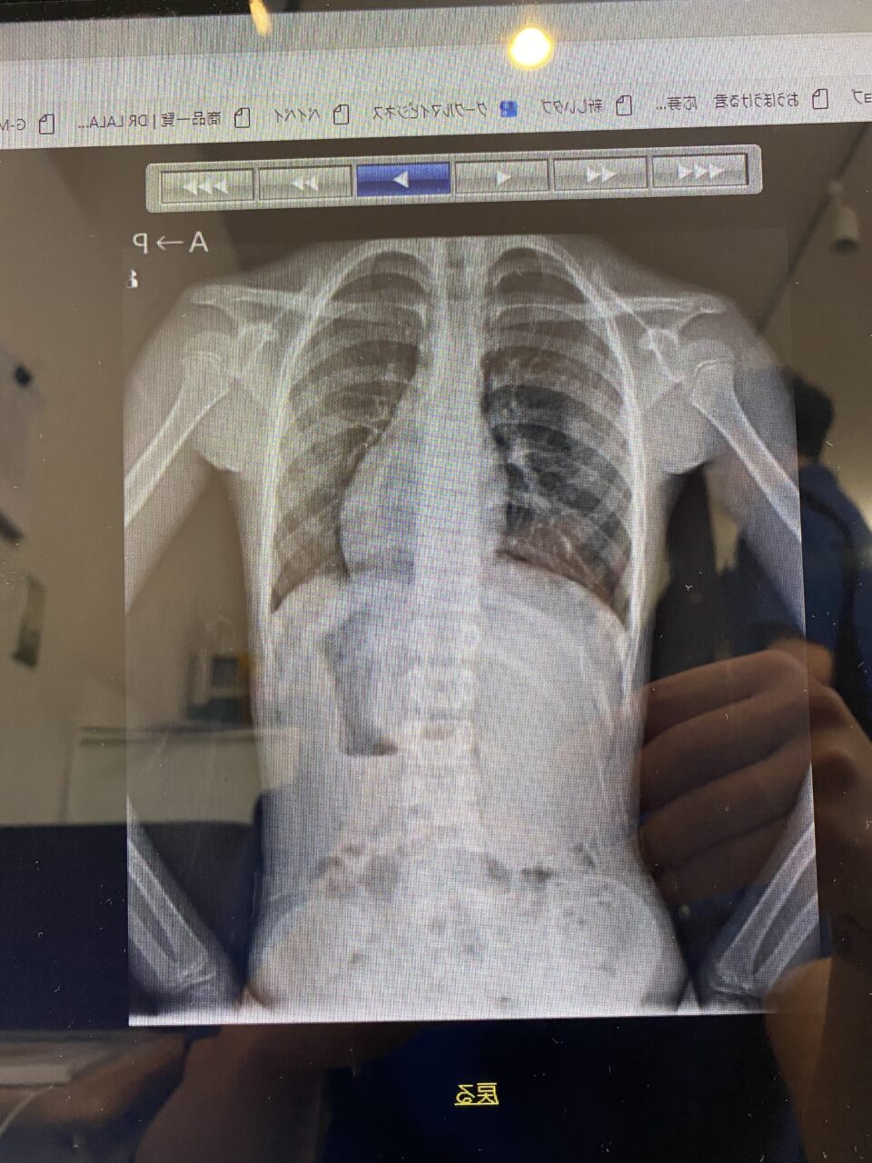 医師は意外と何にも知らない の症例写真