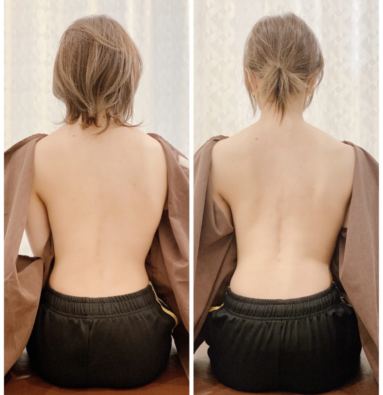 30代だって骨格は改善する の症例写真